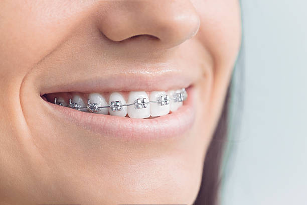 Best Teeth Whitening  in Burbank, IL